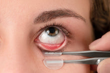 Load image into Gallery viewer, Meivertor™ Lid Eversion Handle