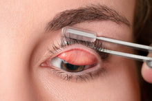 Load image into Gallery viewer, Meivertor™ Starter Kit